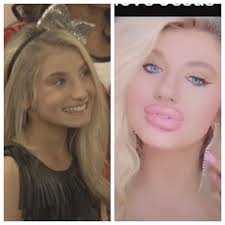 Sections show more follow today plastic surgery might not only help make people. 19 People Who Took Plastic Surgery Too Far In 2021 Plastic Surgery Gone Wrong Plastic Surgery Plastic Surgery Fail