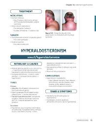 Image result for Hyperaldosteronism