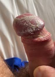 My cock full of smegma - ThisVid.com