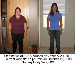 Gastric Sleeve Surgery Gastric Sleeve Gastric Sleeve Surgery Sleeve Surgery