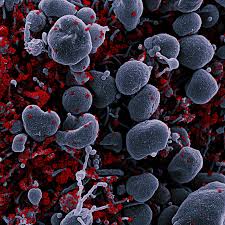 Thu, aug 12, 2021, 4:00pm edt U S Clinical Trial Results Show Novavax Vaccine Is Safe And Prevents Covid 19 National Institutes Of Health Nih