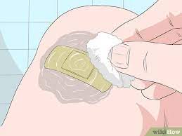 See full list on wikihow.com 3 Ways To Remove Bandage Adhesive From Skin Wikihow