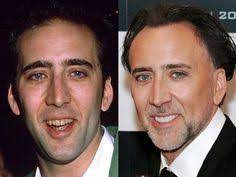 23 Holywood Smile Ideas Celebrity Smiles Celebrity Teeth Dental Veneers
