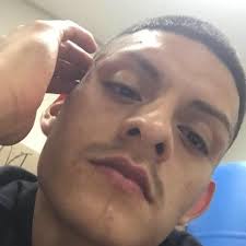 Any recommendations for cloudy bulldog eyes treatment?