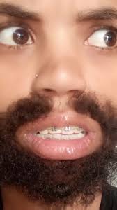 ቀራንዮ ሞጣ: የቪዲዮ ተከታታይ እና ታሪካዊ ሙዚቃ