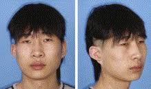 Table of Contents page: Journal of Plastic, Reconstructive & Aesthetic  Surgery