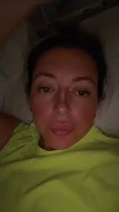 Ear update #fyp #menieresdisease