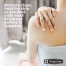 Sulfur 6 acne treatment language:de. Amazon Com De La Cruz 10 Sulfur Ointment Acne Treatment Medication To Clear Cystic Acne Pimples And Blackheads On Face And Body Made In Usa Jumbo Size 5 5 Oz Beauty