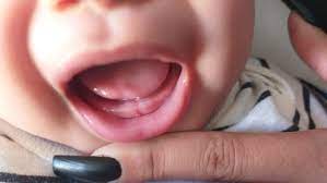 Cuanto Tarda En Salir El Primer Diente Club De Bebes Julio 2020 Babycenter