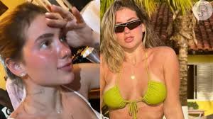 Foto: Virgínia Fonseca acabou ficando com insolação após exagerar no sol -  Purepeople