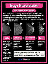 Image result for Mammogram Interpretation