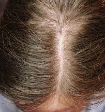 A concentrated serum for hair that looks thicker, denser, fuller, and healthier. The Ordinary Multi Peptide Serum Reviews