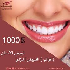 لفترة محدودة تبييض الاسنان قوالب التبييض المنزلي 1000 ريال مجمع عيادات بيرل اسنان جلدية ليزر الرياض الازدهار 0112632424