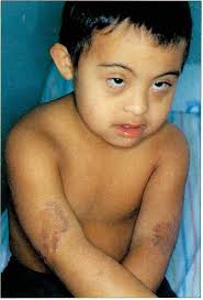 INVESTIGACION ORIGINAL