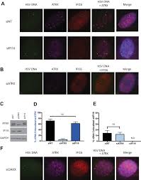 Signs and symptoms, transmission, challenges, treatment, global impact and who response. Atrx Promotes Maintenance Of Herpes Simplex Virus Heterochromatin During Chromatin Stress Elife