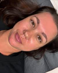 ➡️ Swipe for before. Big beautiful changes to this shape 😍