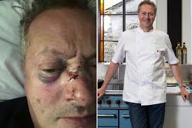 Nick nairn's restaurant badly damaged after fire tears through kitchen with diners present. Celebrity Chef Nick Nairn Left Black And Blue After Savage Beating In Attack Outside Cookery School Mirror Online