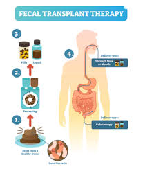 Image result for Transplantation