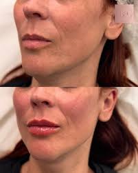 Kelly Hayward (@beautiful_aesthetics_bykelly) • Instagram photos and videos