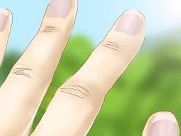 how to get rid of yellow nails 10