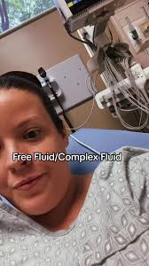 Free Fluid in Pouch of Douglas Meaning