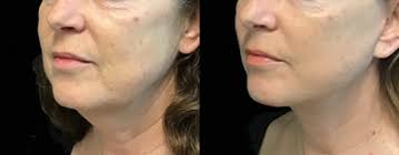 David Sharp, MBBS, FRACS, Specialist Plastic Surgeon