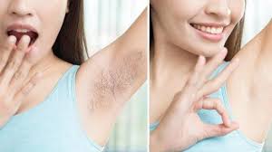 Cara menghilangkan ketiak hitam dan berbulu. Wow Ini Cara Menghilangkan Bulu Ketiak Secara Permanen Dengan Bahan Alami