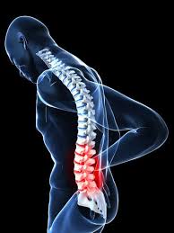 Slipped Disk Body Causes What Is A Slipped Disk Arthritis Symptoms Arthritis Prevent Arthritis