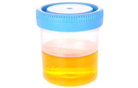 Salt pregnancy test procedure first, add a couple of spoonfuls of common salt in a clear bowl or cup. Natural Homemade Pregnancy Tests