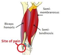 The most common tendon behind knee. Lateral Knee Pain Diagnosis Treatment Knee Pain Explained