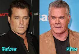 Ray liotta before and after plastic surgery. 46 Movies Ideas Ninja Turtles Art Tmnt Art Ninja Turtles Artwork
