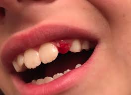 It S Time For That Baby Tooth To Go Charlotte Smiled