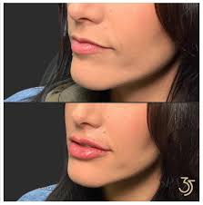 Photo by Briia Bliss (@briia_bliss) · September 13, 2024