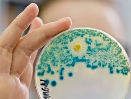 Wisst ihr ab wann penicillin/ antibiotika anschlagen sollte? Antibiotika Resistenzen Who Drangt Auf Entwicklung Neuer Arzneien Der Spiegel