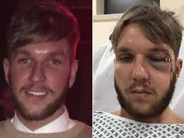 Non-league footballer has career ended after just ONE game through horror  head injury