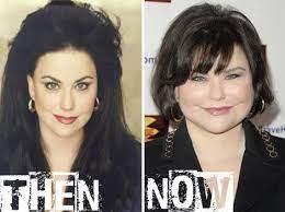 Many wondered why she had to undergo such an operation . Celebrity Delta Burke Before After Plastic Surgery Http Plasticsurgeryclass Com Celebrity Delta Burke B Plastic Surgery Celebrity Plastic Surgery Hairstyle