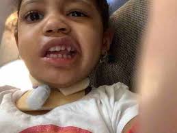 Fundraiser for Frankie Davis by Kyna Eleazer : Lil Miss Kaianne Davis