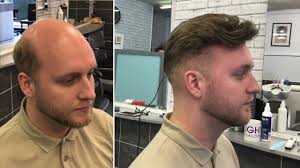 At a hair salon, you can get a number of services beyond a simple hair cut like a manicure or hair coloring. Hair Salon Wolverhampton Ladies Gents And Hair Loss Houghs