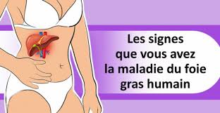Epingle Sur Sante Naturelle