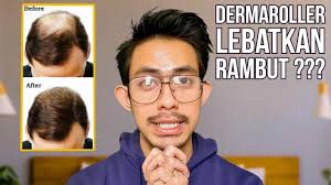 Ini menjadi perkara yang paling kerap dialami oleh ramai wanita. Punca Utama Keguguran Rambut Kenapa Anda Perlu Risau Youtube