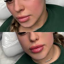 🫧🪄G I V E A W A Y🫧✨ 1 person will win 1ML of needleless 🚫💉 lip filler!  Requirements to enter: 1. Like & follow AJ Rey Aesthetics 2. Invite others  to