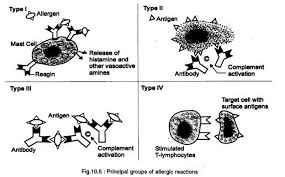 Allergic Reactions Types And Mechanism With Diagram