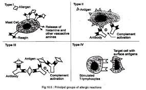 allergic reactions types and mechanism with diagram