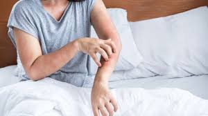 A Step-by-Step Guide on How to Use Permethrin Cream for Scabies