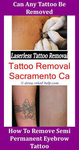 Pin On Tattoo Removal