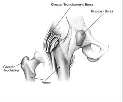 Image result for Bursitis