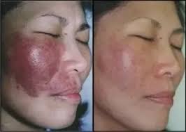 Talk to our specialists, call 0412144015. How To Do Permanent Makeup Tattooing At Home Quora