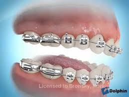 Pin On Orthodontics