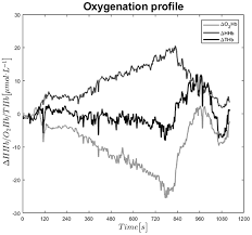 Sign in to check out what your friends, family & interests have been. Frontiers Oxygen Availability In Respiratory Muscles During Exercise In Children Following Fontan Operation Pediatrics