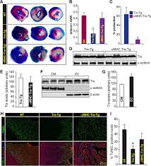 Maybe you would like to learn more about one of these? Thioredoxin Uses A Gsh Independent Route To Deglutathionylate Endothelial Nitric Oxide Synthase And Protect Against Myocardial Infarction Journal Of Biological Chemistry